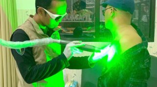 Petugas medis menghapus tato menggunakan laser